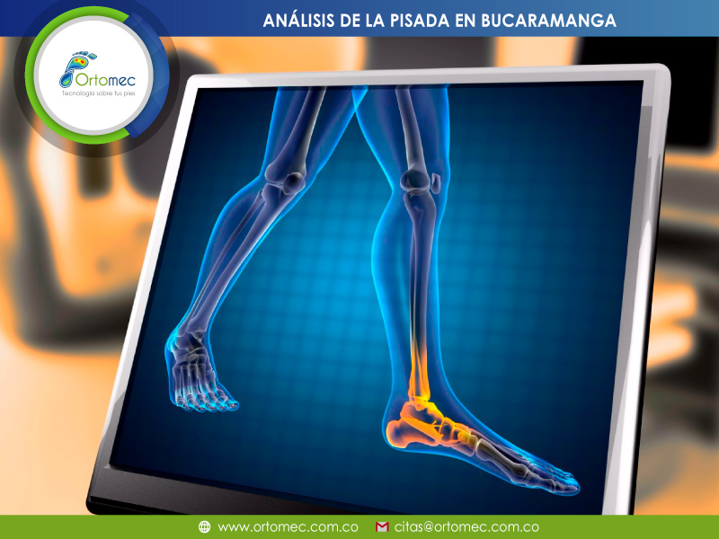 análisis de la pisada análisis de la pisada