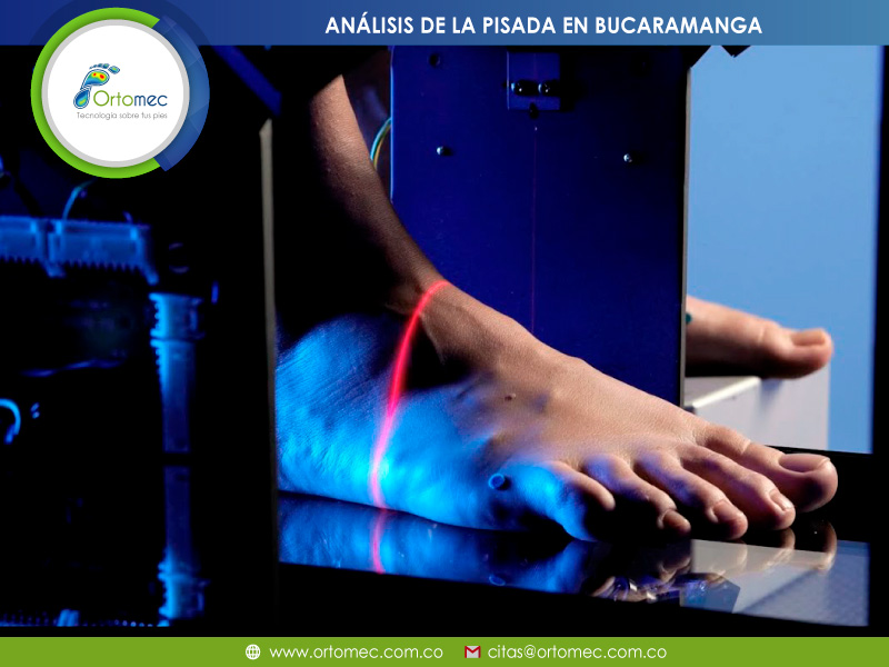 Análisis y estudio de la pisada Análisis y estudio de la pisada en Bucaramanga