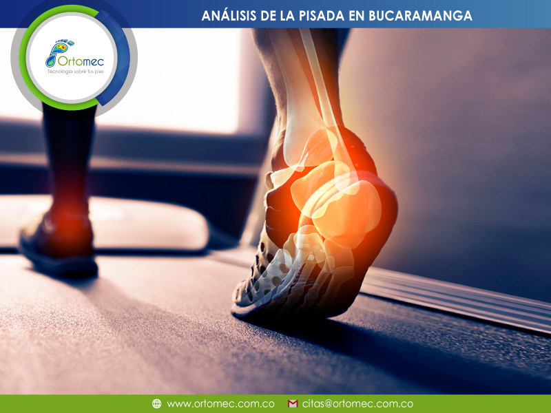 Expertos en Análisis de la pisada en Bucaramanga Análisis de la pisada en Bucaramanga