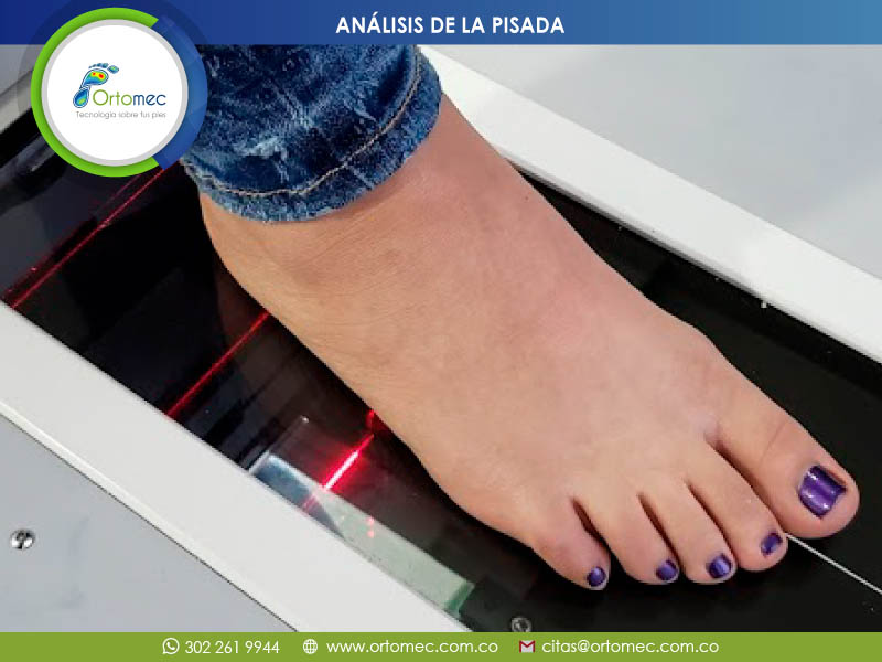 Análisis de la Pisada