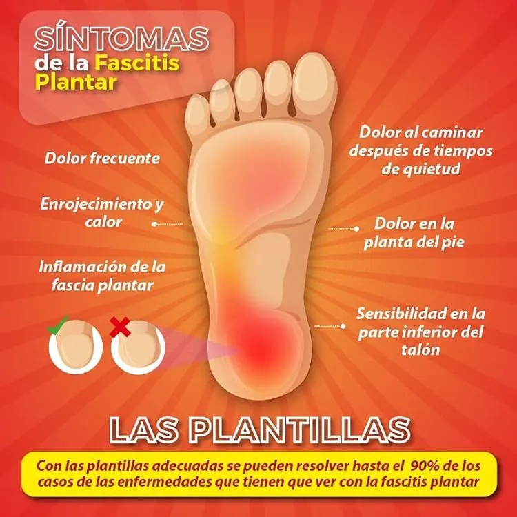 Plantillas para fascitis plantar