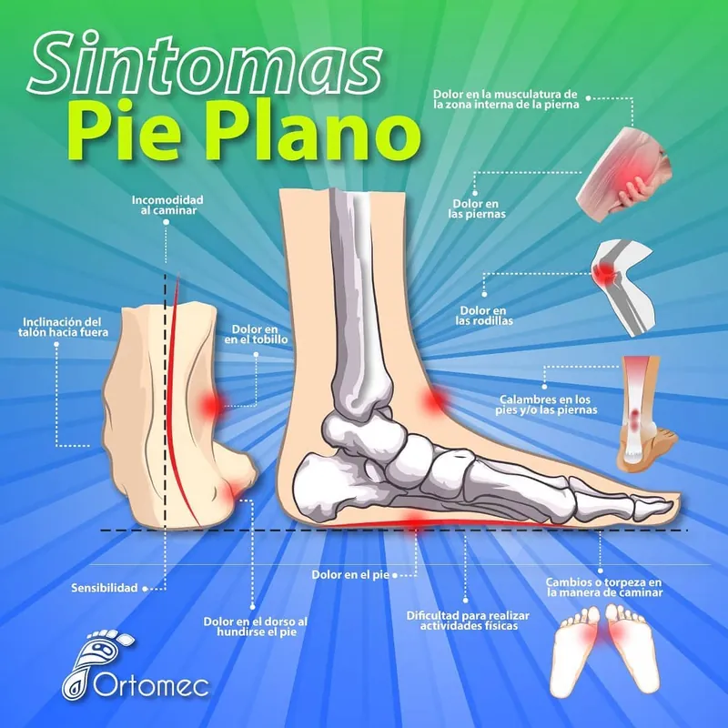 Plantillas para pie plano