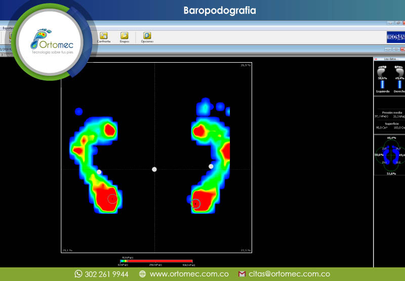 servicio de Baropodometría Bogotá
