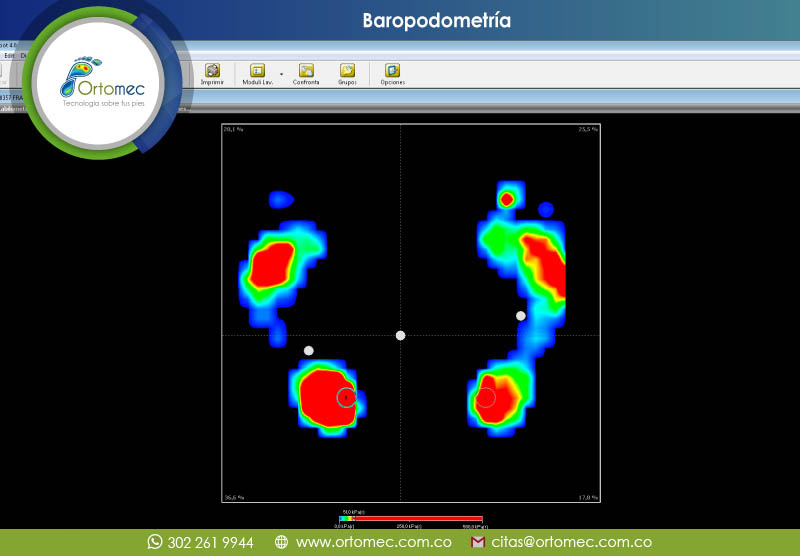 medicion simultanea de presiones plantares